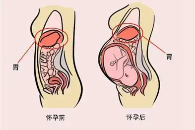 孕妇怀孕前怀孕后通常会有肚子变化,内脏器官变化,骨盆变化等.