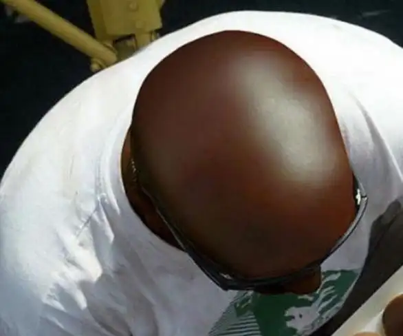 好大一颗卤蛋,原来是哥们的脑袋啊!