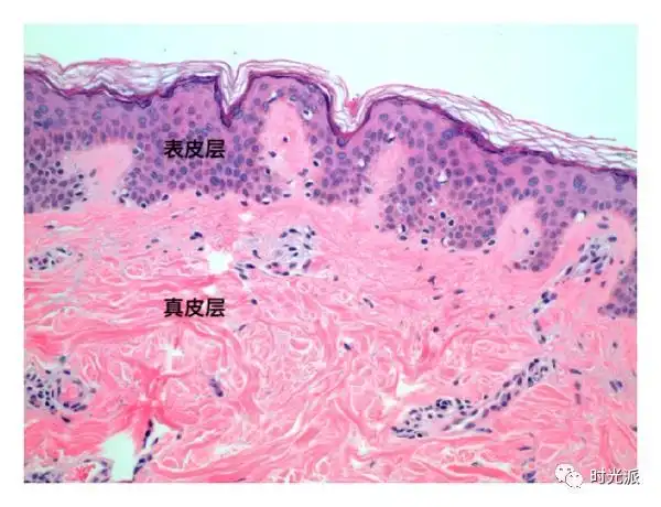 皮肤分三层:表皮层(epidermis),真皮层(dermis),皮下组织层