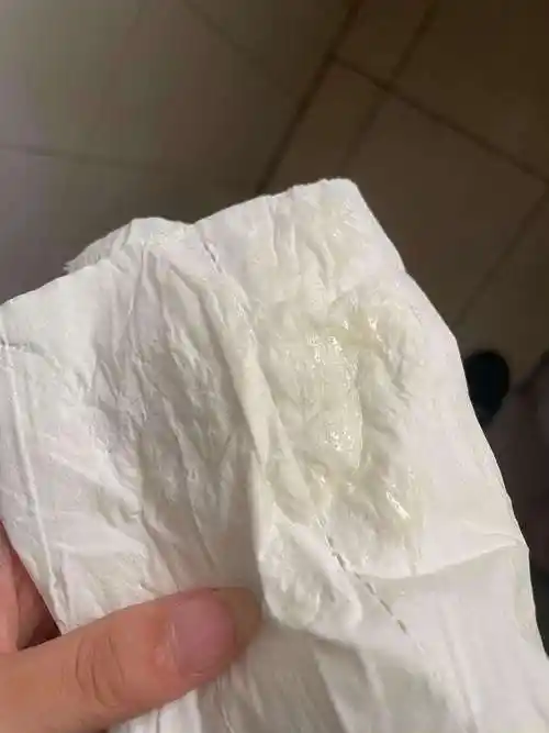 白带发黄是怎么回事 分泌物发黄无异味是怎么回事