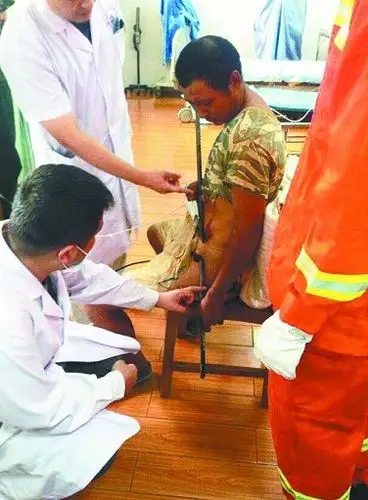 一木工遭天降4米钢筋刺穿肚子 医生求助消防员