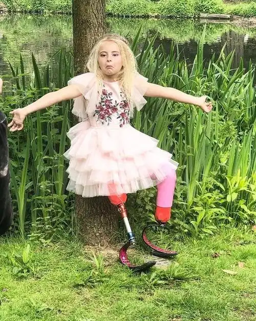 双腿截肢的9岁小仙女登上了纽约时装周还获邀去巴黎走秀不认命就是我