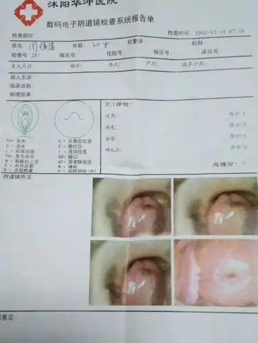 提问 我宫颈口朝上,和老公同房的时候为什么碰到宫颈就会疼呢!