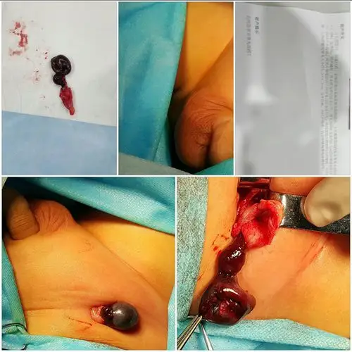 看实力!睾丸发育不良无精症能治愈吗"瓜瓞绵绵"-第2张图片-康夫博客