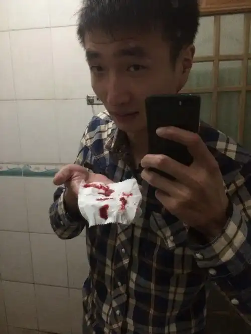 耳朵后面长了个硬包疼怎么回事