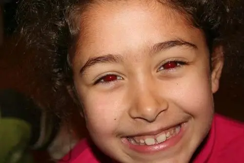 几个技巧教你如何避免红眼