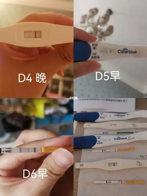 囊胚移植d6