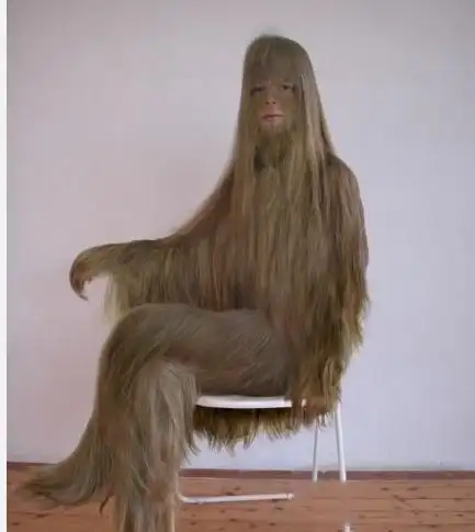 【体毛最多的女孩】此女1983年出生于美国加利福尼