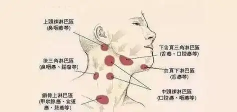 所以,在发现自己患有颈部淋巴结肿大的情况,一定要去