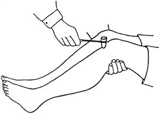 图3-31 膝腱反射检查(5)跟腱反射:让受试者仰卧,髋外展外旋,医生用手