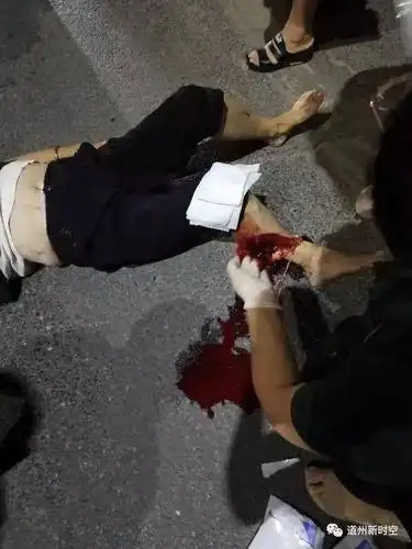 昨晚道县和一路口发生一起车祸:惨不忍睹