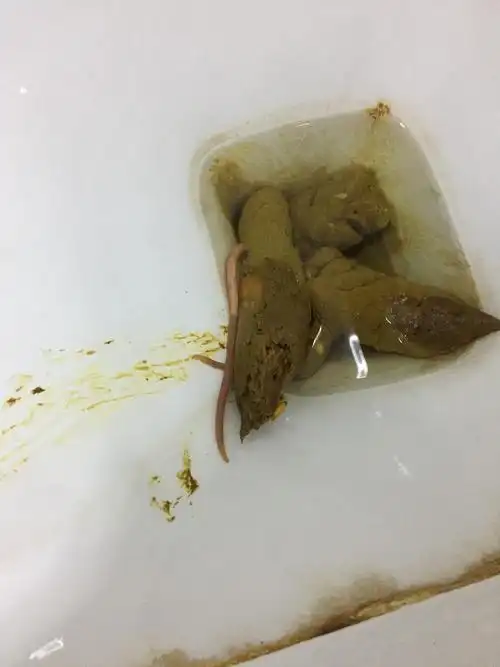 作为一个中年妇女居然拉出来一条粉红色虫子