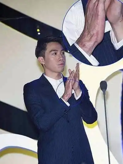 俞灏明烧伤前后对比照真是刺激了眼睛和内心.