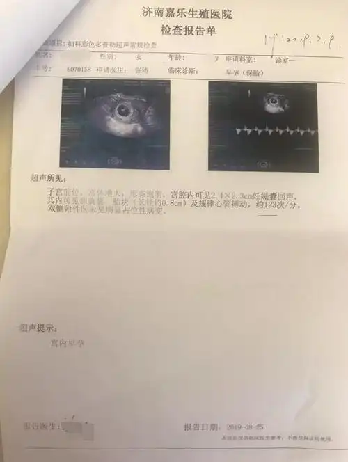 3次胎停育2次流产,二胎艰难路终见柳暗花明