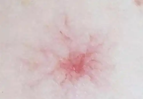 42岁男子,不痛不痒,却查出肝癌,提醒:身体出现三种异常,及时检查_手机