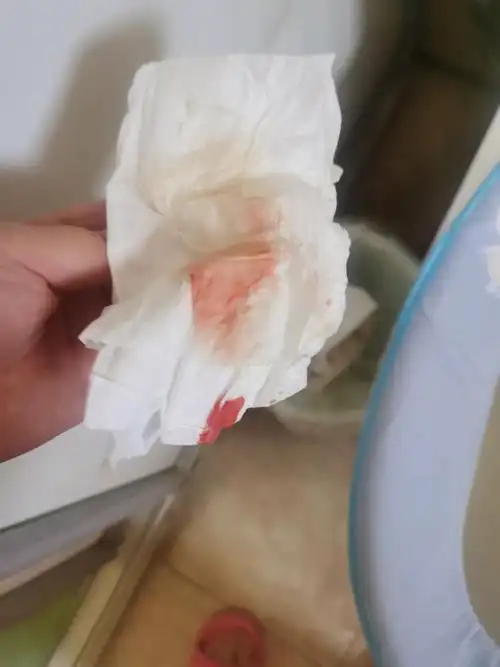 [试管婴儿]移植后第十九天,出血了,纸上有