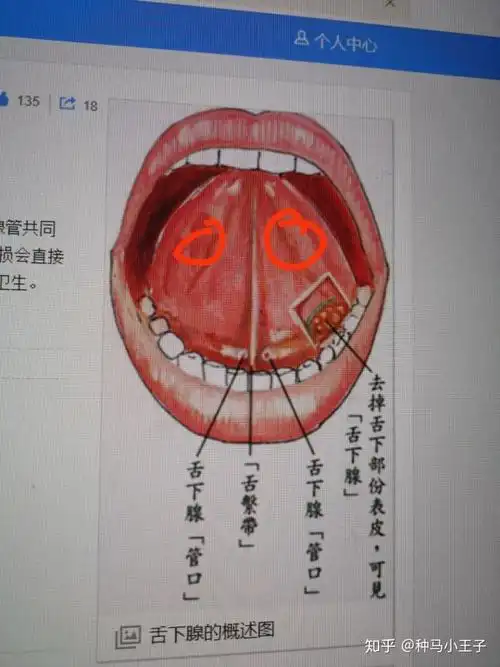 舌头下面有两个对称位置的腺体,不一样大,你们都是这样的么,刚刚用