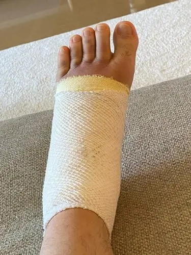 庾澄庆跑步扭伤脚肿似肉包做鬼脸难掩面色憔悴