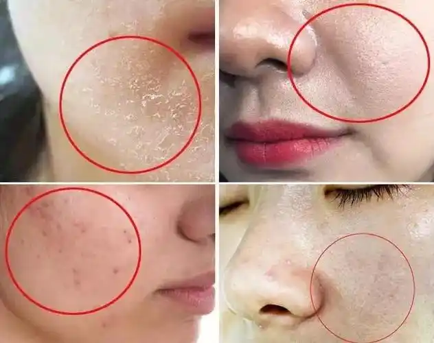 3秒润透真皮层10分钟皮肤透亮1度这款面膜好用到想推荐给身边所有人