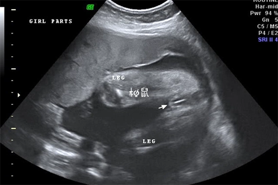 三条线是男孩还是女孩