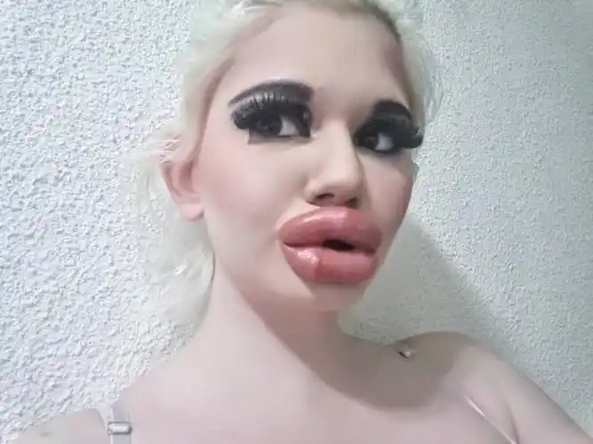 她做20次丰唇手术,只为让自己嘴唇更性感,想成世界嘴唇最厚的人__财经