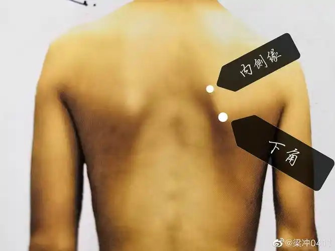 触诊:用手触摸肩胛骨内侧缘,可感受到其背离胸廓及背部肋骨.