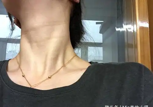 女人脖子出现三条杠你知道表示什么吗别傻傻不在意