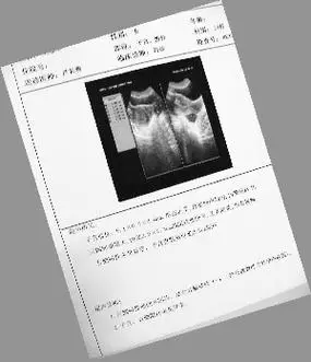 手术做完了病还没查清:宫外孕开腹后竟成了囊肿