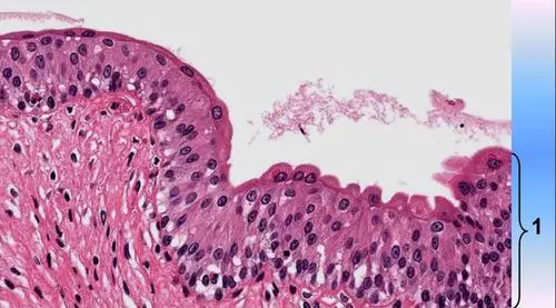 请判断图中1所示的是何种上皮组织?()