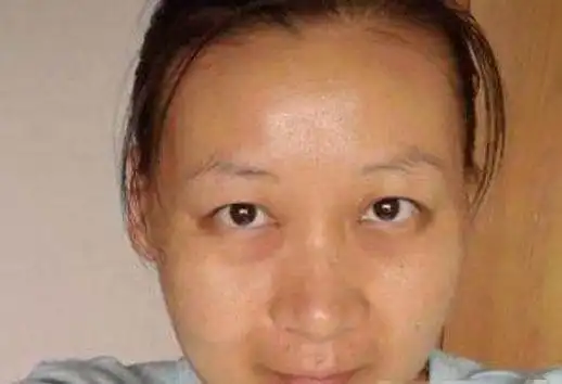 21岁女孩吃此物4年变黄脸婆,切不可忽视!