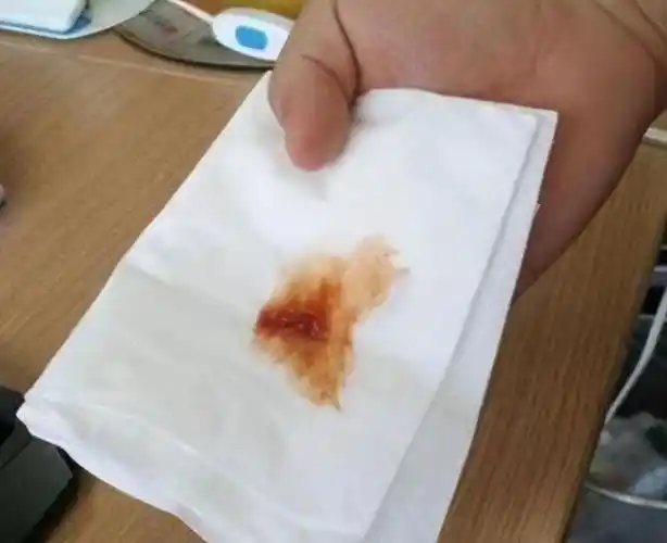 没想到的是,一天夜里,吴女士突然猛烈地咳嗽起来.