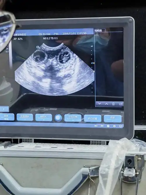 请大家看下怀孕30天心脏没有看到跳动正常吗