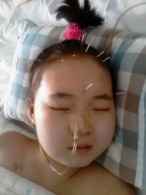 善友筹已审核11岁农村小女孩已在病床上昏迷了10个月医院多次宣告病危