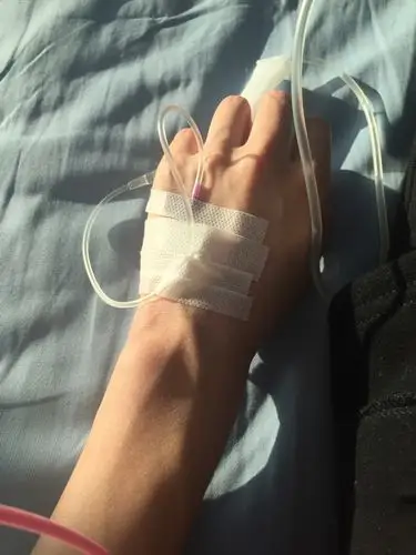 真是不错,终于扎针儿了