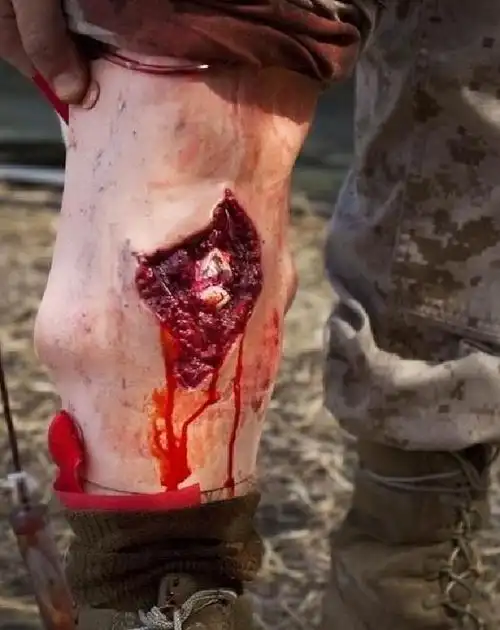 郑希怡泰国坠楼后返港 戴颈托坐轮椅获男友护驾