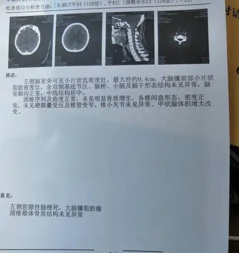 脑部,ct片子问题