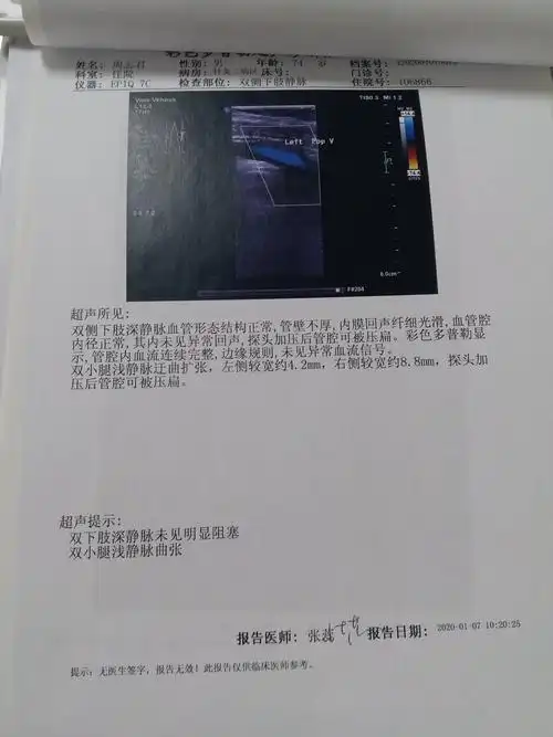 2020年1月7日双腿血管彩超.双腿深静脉没有血栓,双下肢浅静脉曲张.