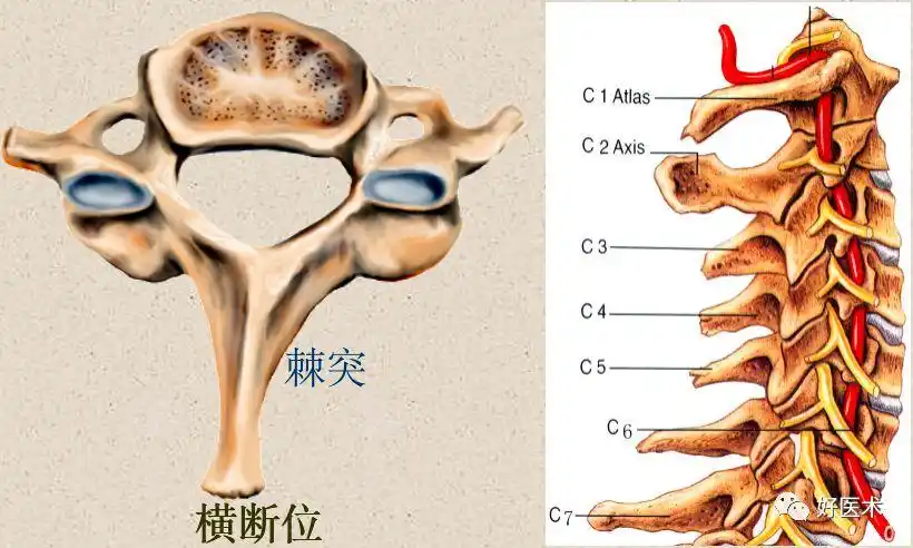 解剖标志大而长的棘突椎骨突起 (c7):3-7颈椎椎体上面外侧缘的椎体钩
