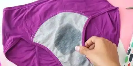 女性内裤上出现一种表现宫颈癌的前兆请及时就医