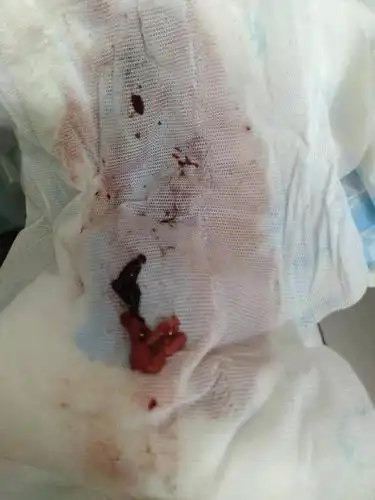 月经这样,出了什么问题吗?