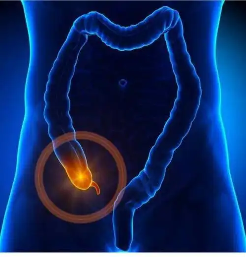 阑尾在什么位置?