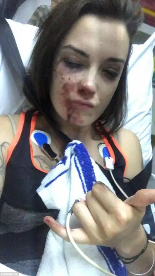 白人女子晚上在公园跑步,遭两名黑人妇女殴打,被打得鼻青脸肿