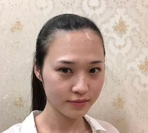 天生的发际线高,秃头逆袭成女神只差设计一个完美的发际线