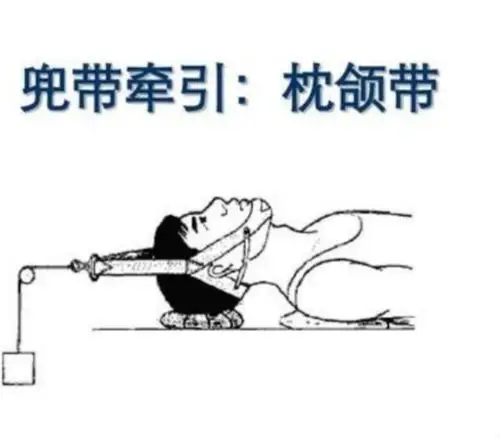 兜带牵引—枕颌带牵引的认知