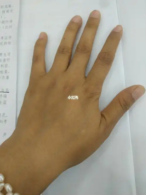 见过这么黑这么黄的手吗