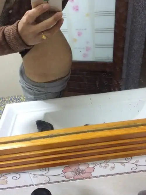 五个月肚子很小 很担心