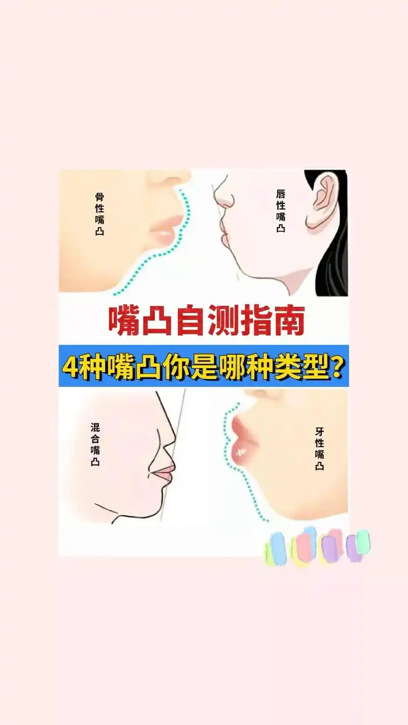 嘴凸自测指南.看图自测4种常见嘴凸类型,你是哪一种今天来给大 - 抖音