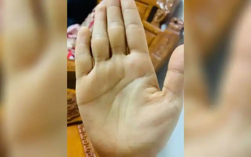 手相实例:感情线岛纹,期待完美爱情是奢侈吗?