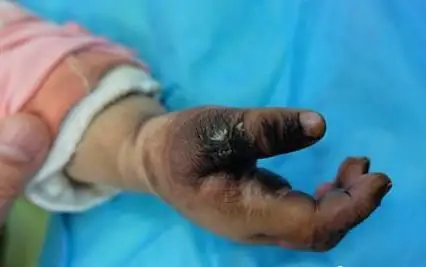 3岁男童用铁钉戳插座孔触电身亡,谁之过?