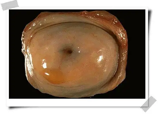 阴道一指深有肉一样的东西